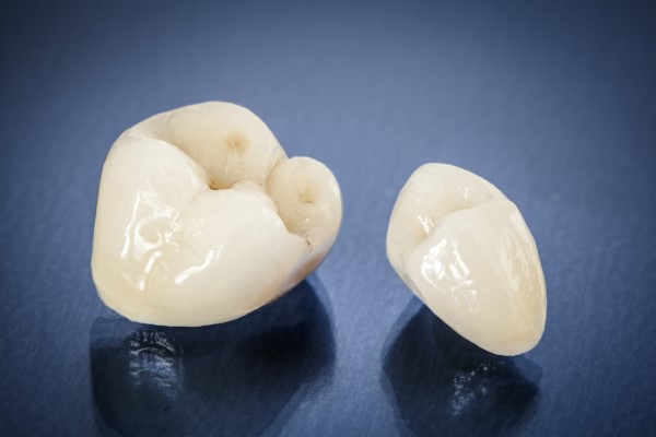 CEREC® Crowns Vs  Traditional Dental Crowns