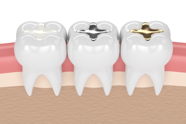 What Is A Tooth Filling Made From?
