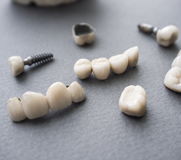 Arlington The Difference Between Dental Implants and Mini Dental Implants